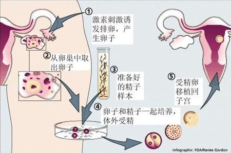 试管代怀公司门诊